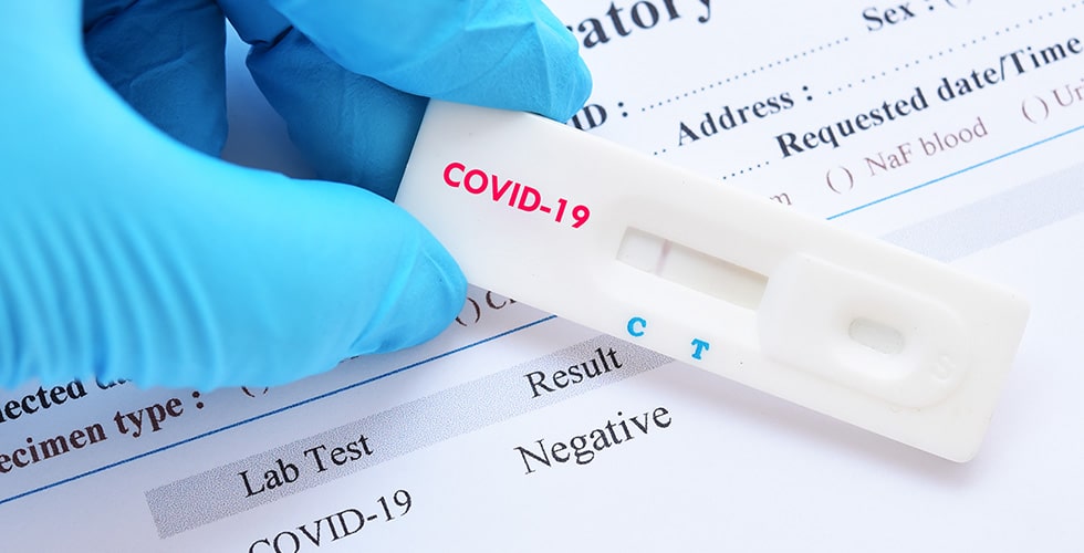 Test antigénique rapide de la COVID-19 pour le dépistage du virus Sars-Cov-2